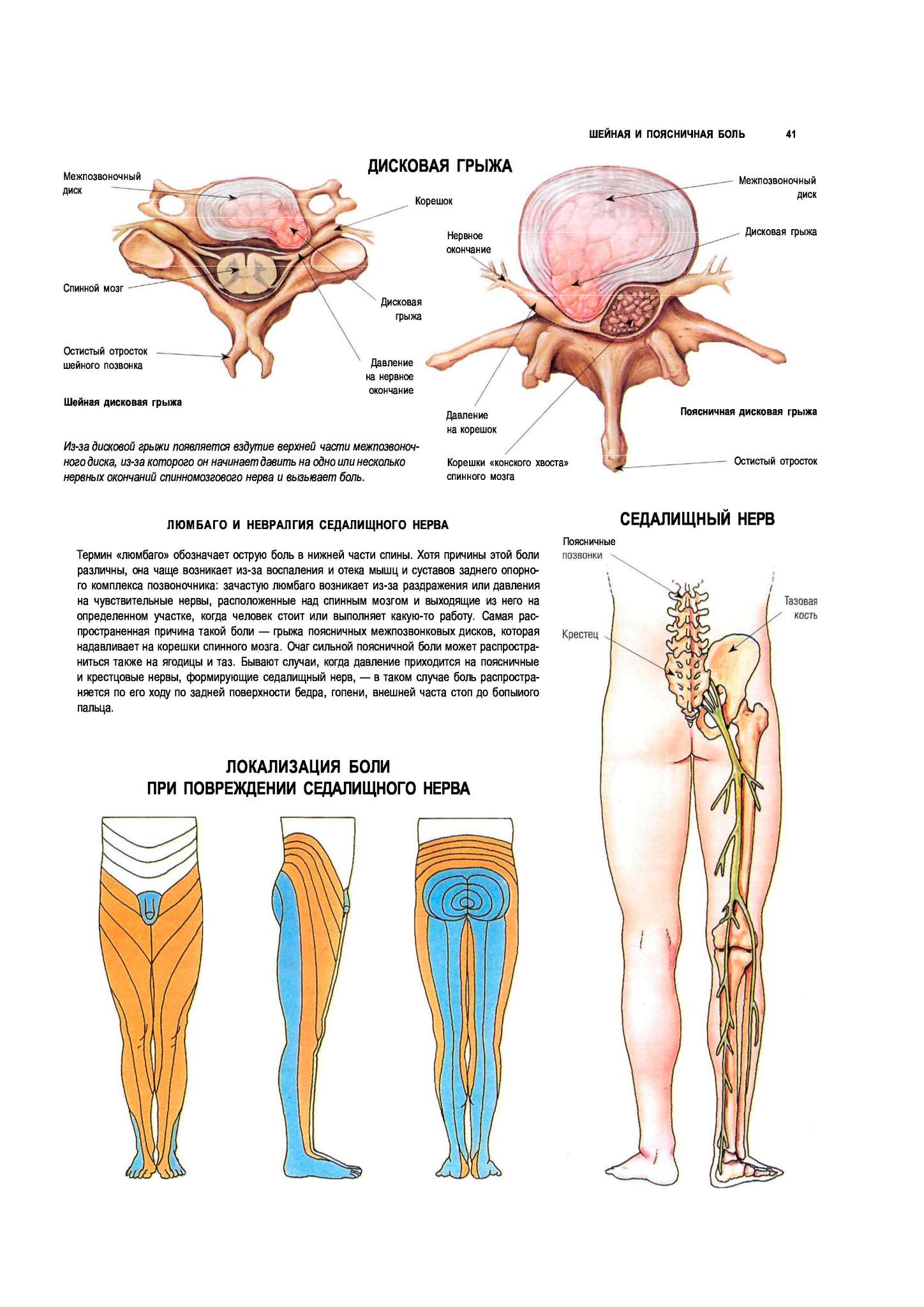 Люмбаго это. Анатомическое расположение седалищного нерва. Седалищный нерв локализация. Седалищный нерв схема расположения. Скелет позвоночника седалищный нерв.